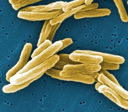 Pathogen photo.